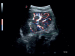 УЗД апарат MyLab Gamma - Фото 2