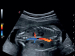 УЗД апарат MyLab Gamma - Фото 3
