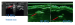 Високочастотний ультразвук Flossy - Фото 4