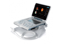 УЗД апарат MyLab Alpha
